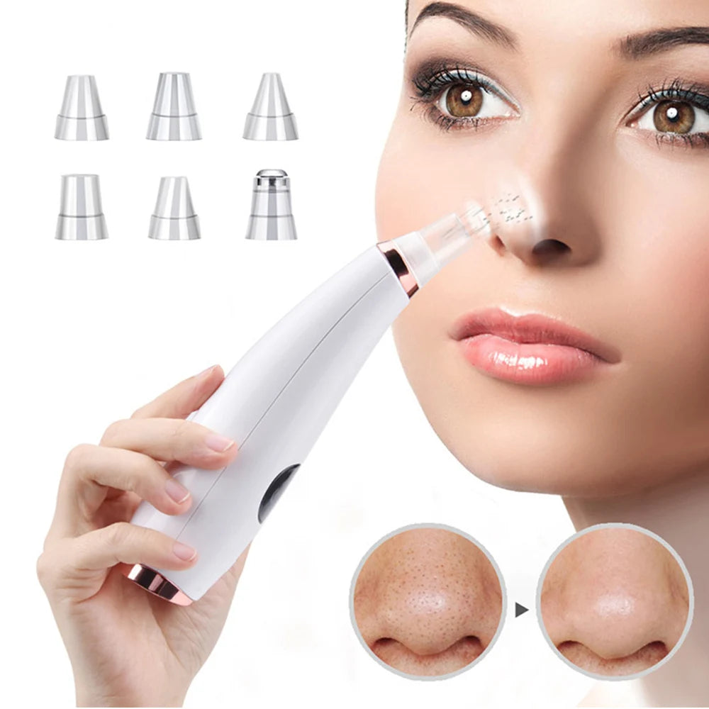 ACNE & BLACKHEAD VACUUM CLEANER